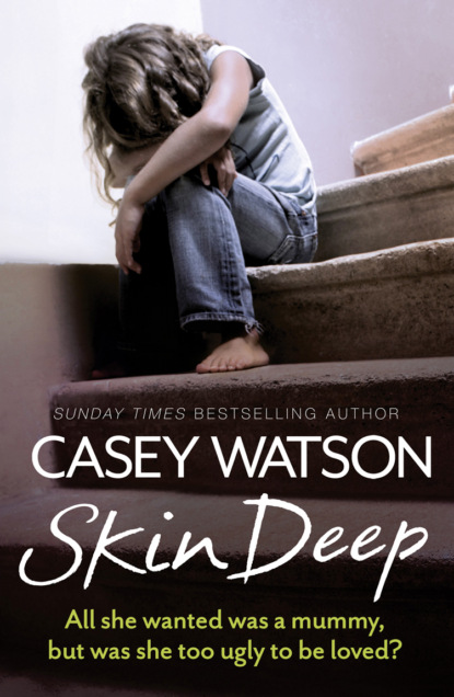 Скачать книгу Skin Deep: All She Wanted Was a Mummy, But Was She Too Ugly to Be Loved?