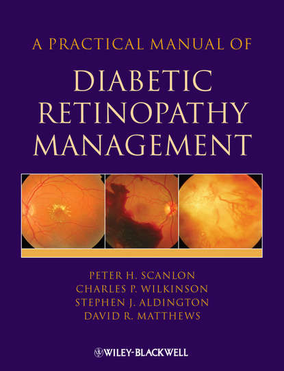 Скачать книгу A Practical Manual of Diabetic Retinopathy Management