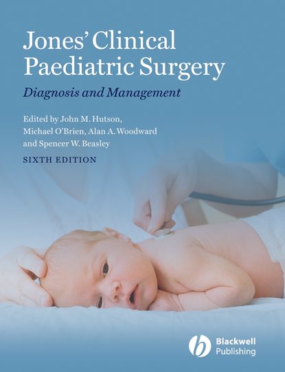 Скачать книгу Jones' Clinical Paediatric Surgery